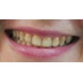 Отзыв о Эмаль для зубов Color professional: 
