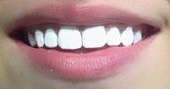 Эмаль для зубов Color professional - Идеальное средство