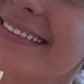 Отзыв о Эмаль для зубов Color professional: Идеально для тех кому нельзя отбеливать.