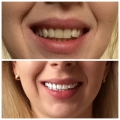 Отзыв о Эмаль для зубов Color professional: Великолепное средство! У меня нет слов!