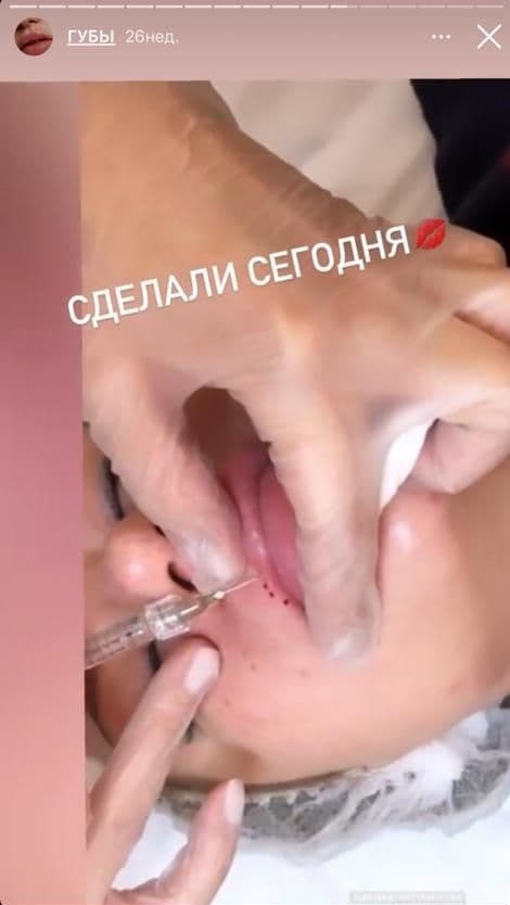Косметолог Мочалова Виктория Ильинична - Проводит процедуры без мед образования