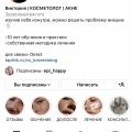 Отзыв о Косметолог Мочалова Виктория Ильинична: Проводит процедуры без мед образования